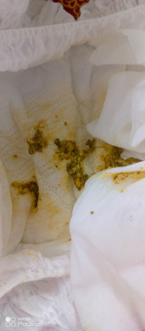 Mga mi about sa poop ni baby