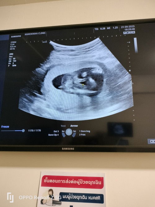 ช่วยดูหน่อยคะ