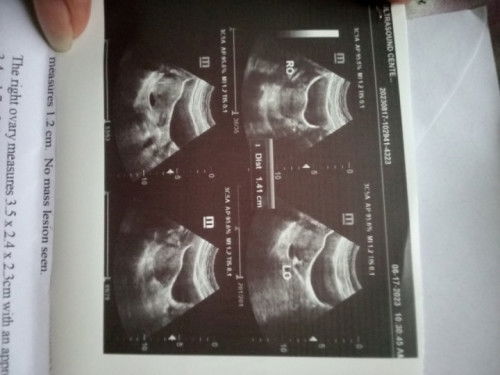 I'm 10weeks pregnant sa mga nag papa ultrasound na Wala pang Makita it's ok lang po ganyan dn aq dti