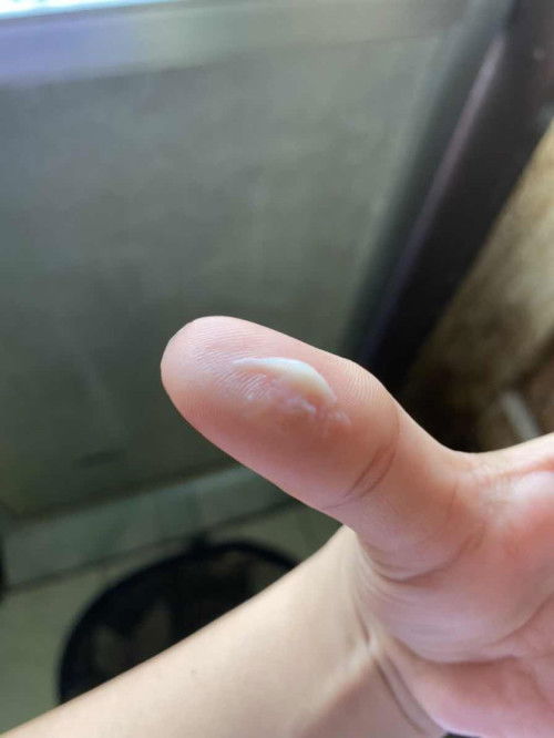 Ano po kaya ito? normal po ba ito currently 35weeks