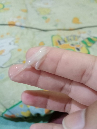 ขอสอบถามหน่อยค่ะเเม่ๆ 2วันนี้ไม่ค่อยรุ้สึกว่าน้องดิ้นเลยค้ะ วันนี้เป็นมูกไสๆหลายออกมา ท้องได้29+3ค้ะ