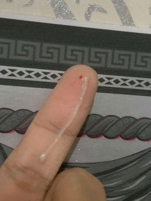 Keputihan dan titik merah sperti darah