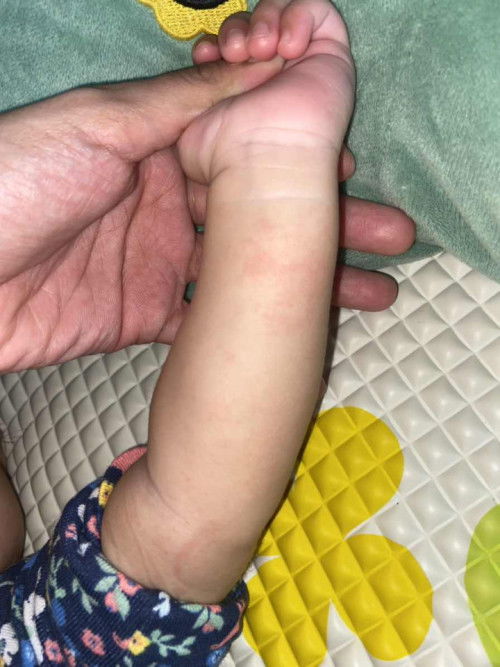 Alergik habuk ke mknn?