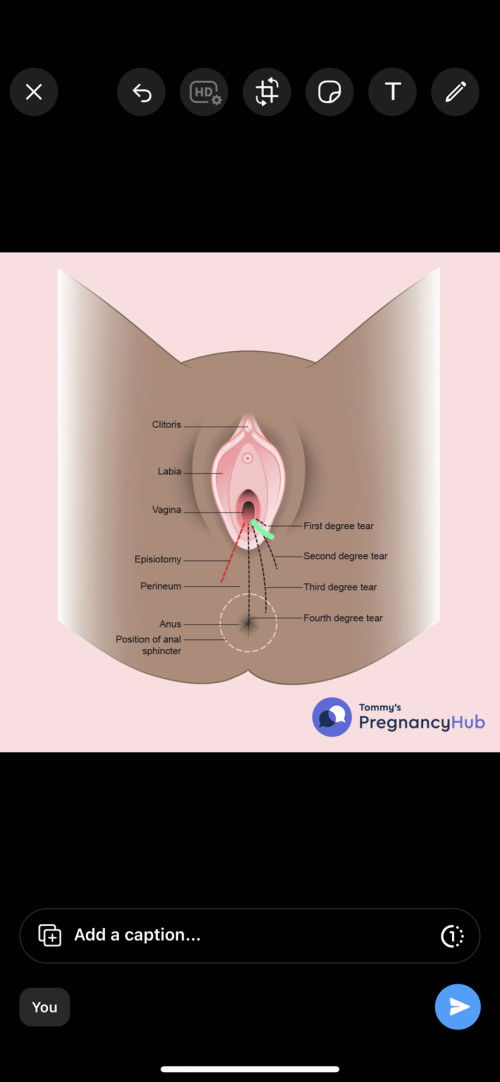 Tips luka cepat kering