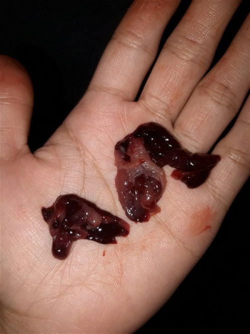 แท้งไหมคะแบบนี้😭