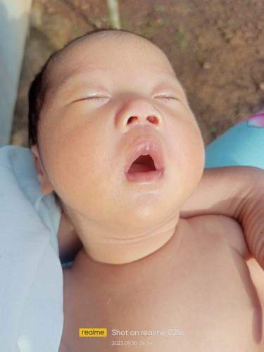 ok lng ba na ganito ang kulay ng bby ko 1mo and 2weeks plang cia sabi namn ng doctor painitan lng