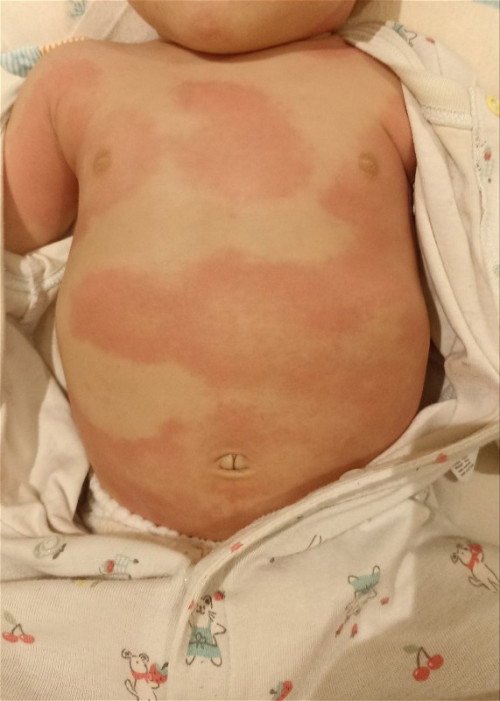 Merah merah satu badan