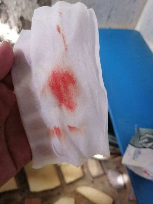 Sign na ba to ng labor? Pa sulpot sulpot lng yung sakit ng balikwang ko at puson nawawala rin agad