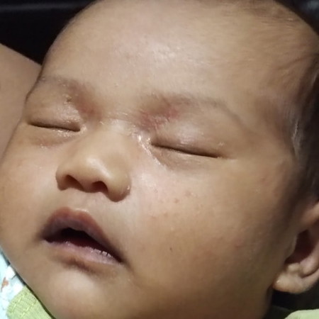ask ko lang po if normal.po yung gantong rashes ni baby and ano pong pwedeng gawin thank you