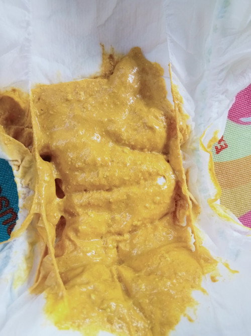 กินนมผงคู่กะนมแม่