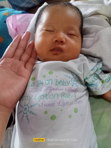 ok lang ba na qanito ang kulay ng baby ko 1mot and 2weeks plang cia parang yellowesh cia