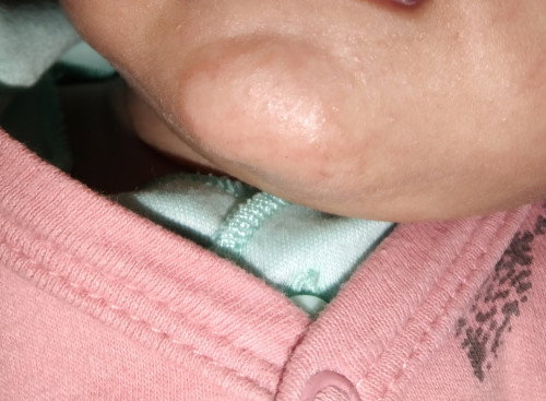 Dagu Bayi 1 bln