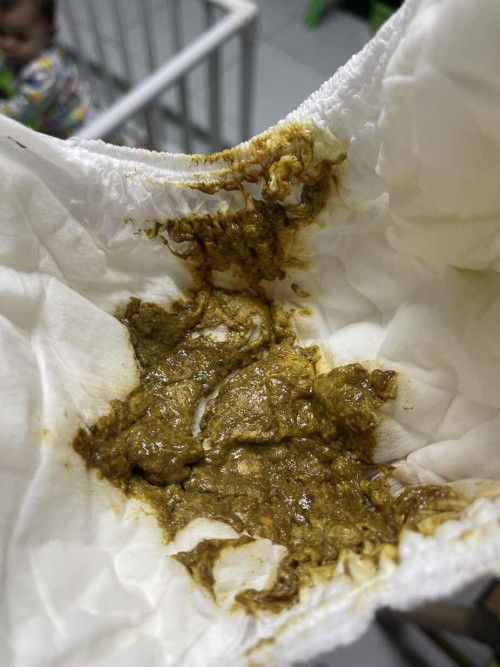 ลูกชาย11เดือน16วันค่ะ ถ่าย3รอบต่อวัน วันนี้เหมือนมีมูกเลือดออกมาค่ะ 1ครั้ง