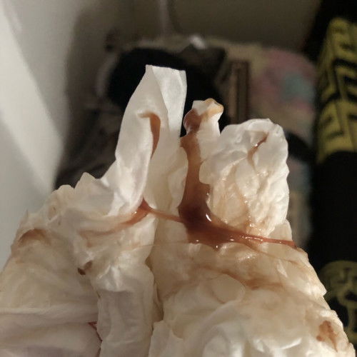 สอบถาม มีมูกแบบในภาพ