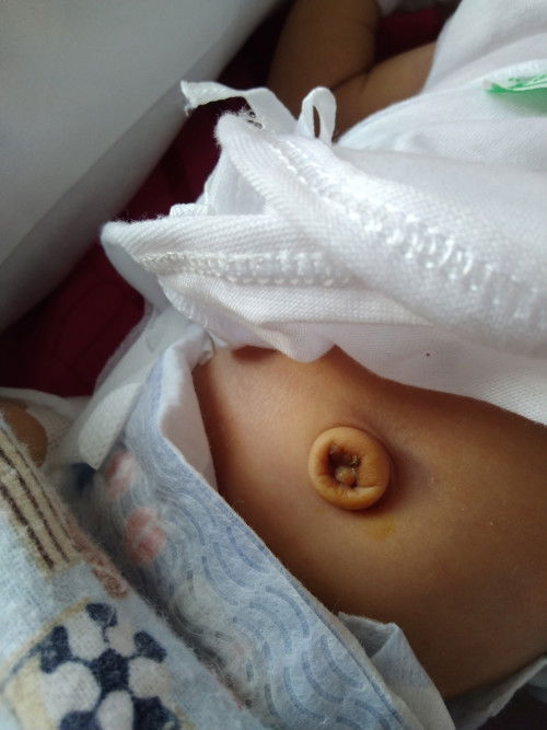 CLIP SA PUSOD NI BABY