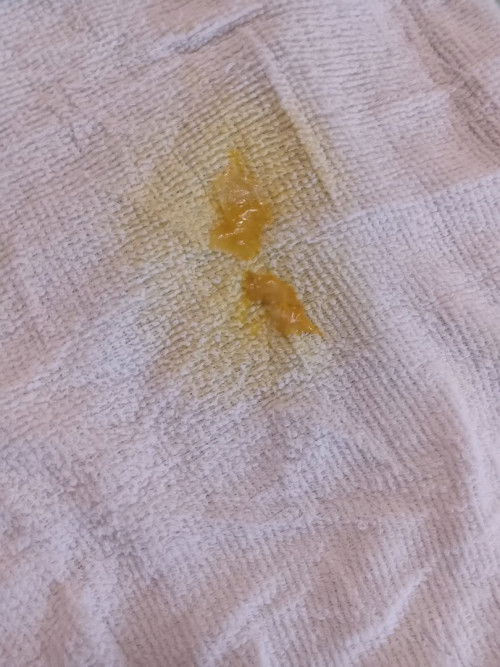 Bé nhà em 1m28d đi ngoài như vậy là bị gì vậy mn