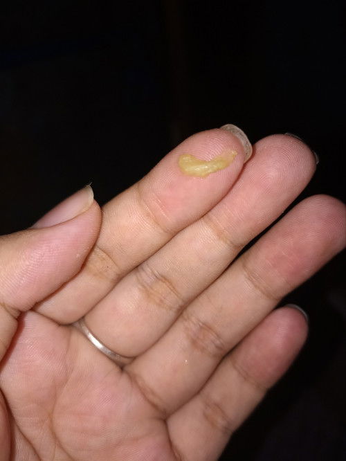 Normal lang po ba tong discharge na yellow 37 weeks and 4 days po ako