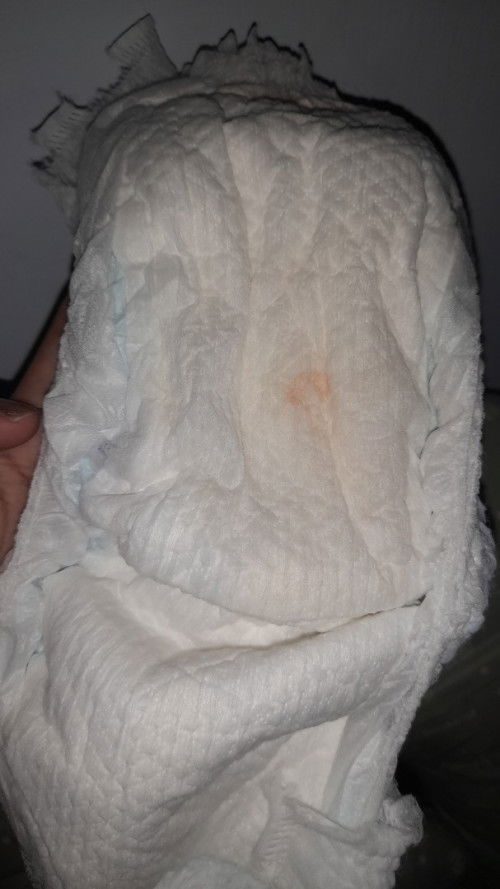 BAK bayi usia 5bulan