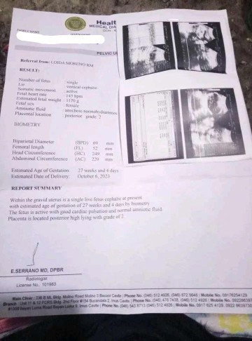 Ultrasound EDD accuracy