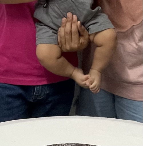 Kaki baby 6 bulan. Normal atau ctev