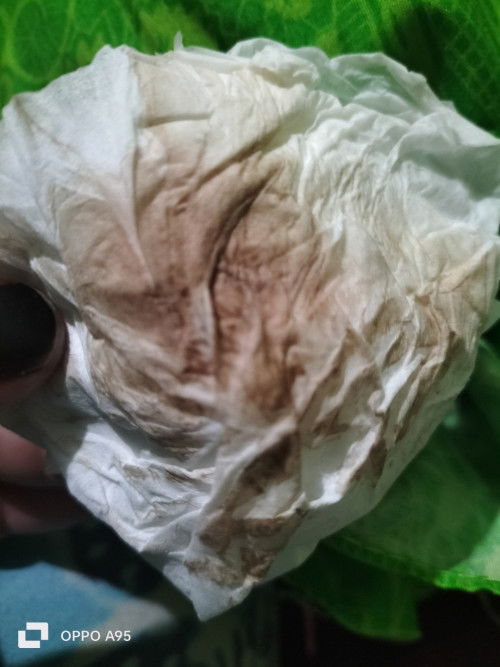 Ass..Bun maaf mau tnya aku udah 39weeks skrng baru pagi ini aku keluar flek coklat rasa sakit bangat