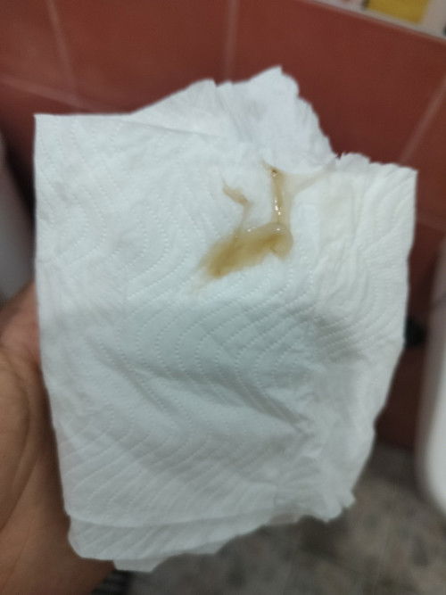 ขอสอบถามแม่ๆๆค่ะ ตั้งครรภ์ได้ 9 วิก แล้วค่ะ