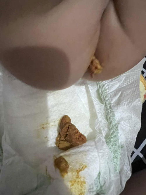 7mons old LO constipated.