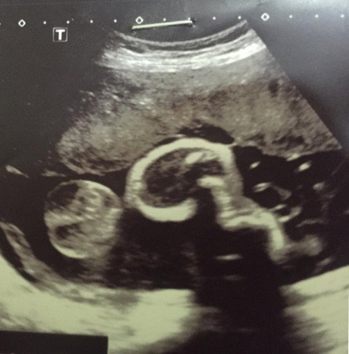 รบกวนช่วยดูให้หน่อยค่ะ ว่าน้องเป็น หญิง หรือ ชาย