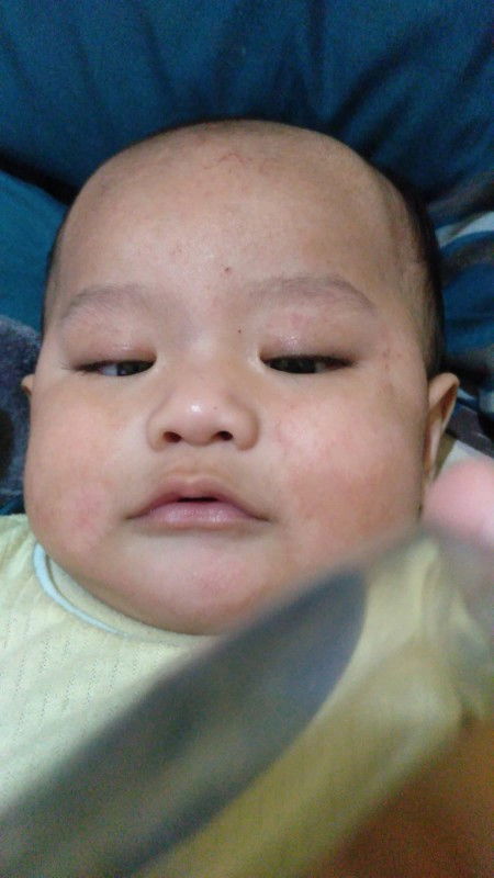 Ruam Pipi Bayi