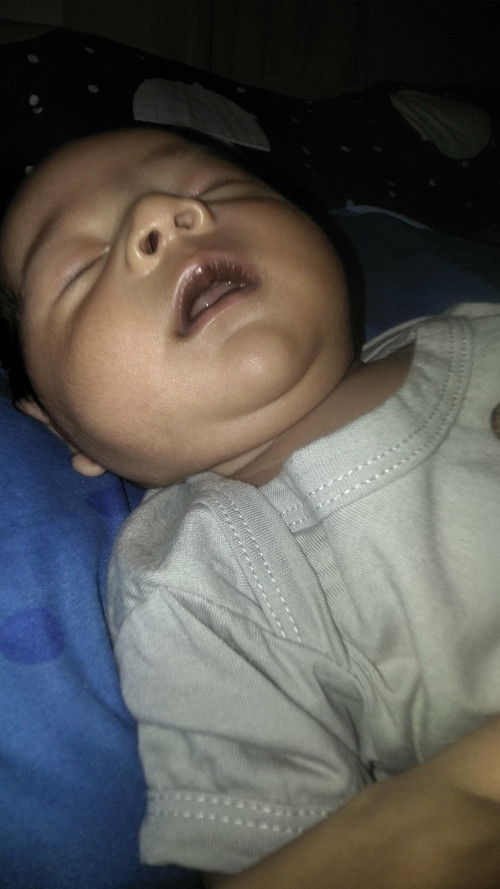 Bibir menghitam newborn