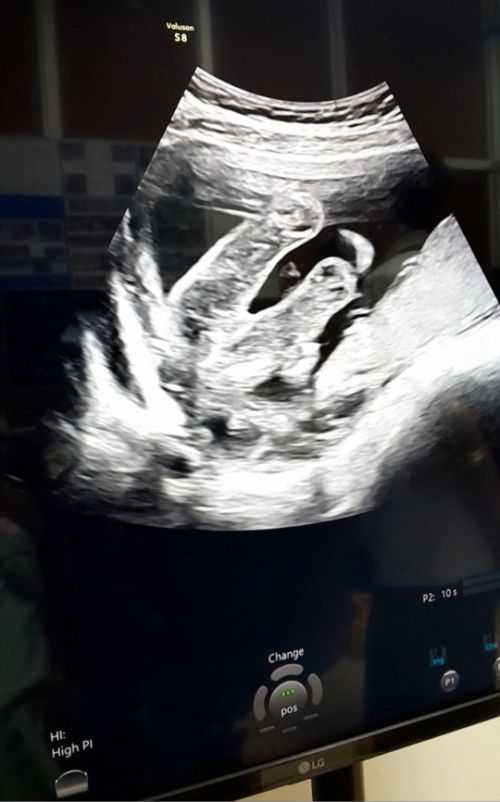 แม่ๆว่าเพศอะไรคะ