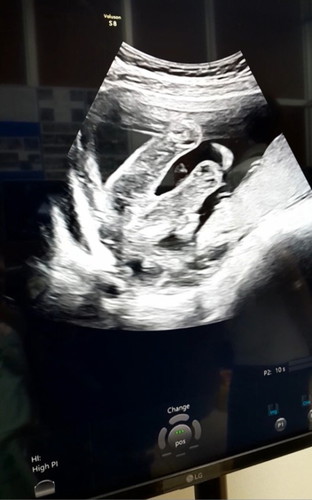 แม่ๆว่าเพศอะไรคะ