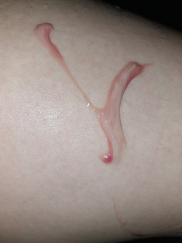 Pasintabi po. ANO PO ITONG LUMABAS SAKIN NA DISCHARGE? 40 WEEKS AND 3 DAYS NAPO KASI AKO NGAYON.