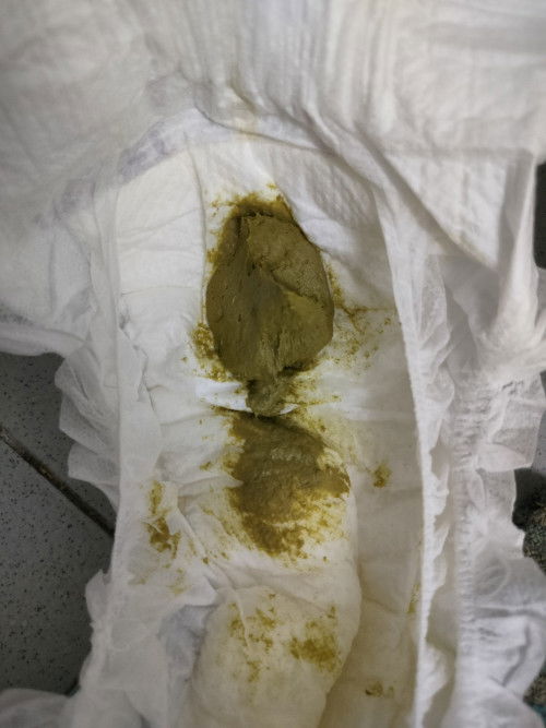 normal berak baby hijau? baby 5bln.