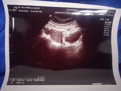 Nanya soal guncangan pelan naik mobil bun