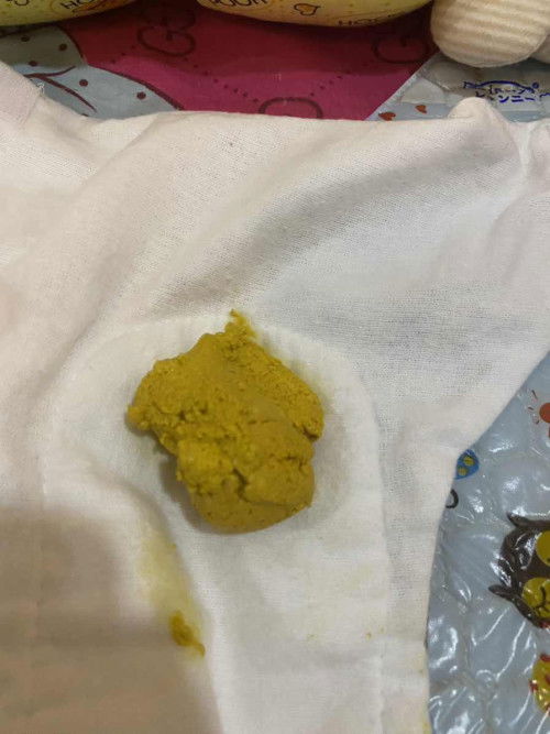 น้องกินนมผง อยากถามว่าถ่ายแบบนี้ปกติไหมคะ