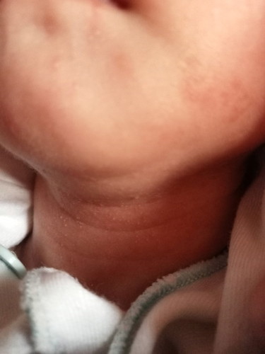 Newborn 1 week