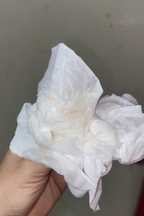 40+2 มีมูกเลือดออก