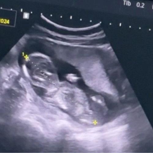 ช หรือ ญ คะ