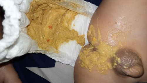 Bun sharing dong tentang feses anak 15 bulan