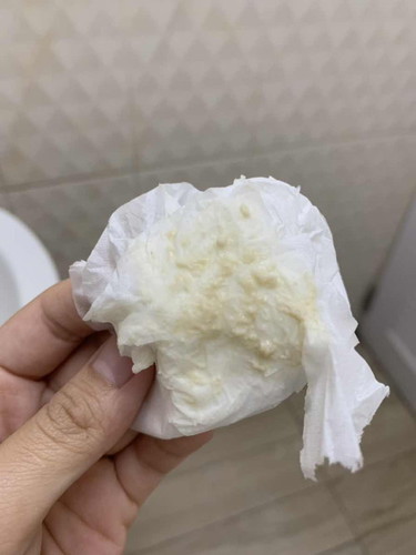 ท้อง6เดือนมีตกขาวแบบนี้ปกติไหมค่ะ