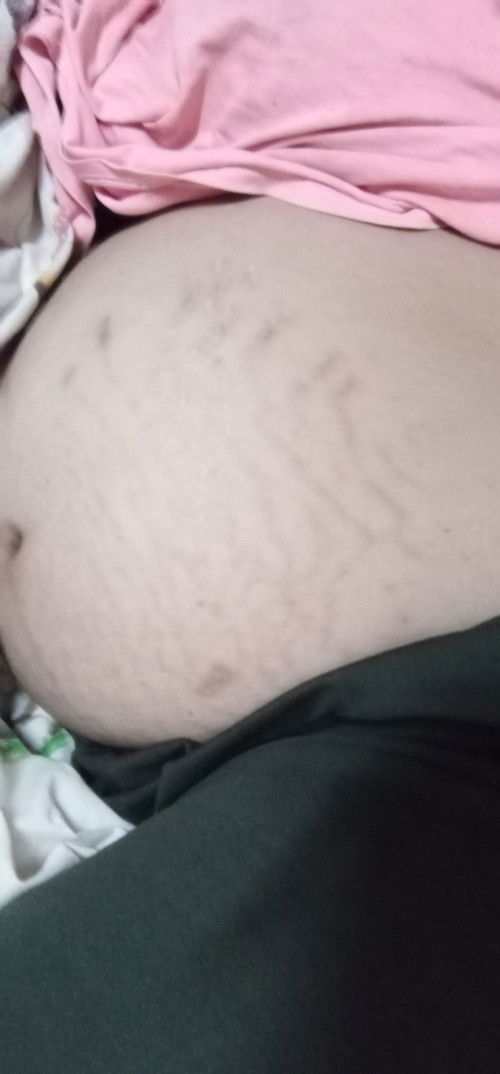 คนตั้งครรภ์​