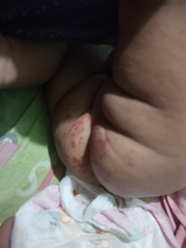 Singaw daw ito ng katawan????