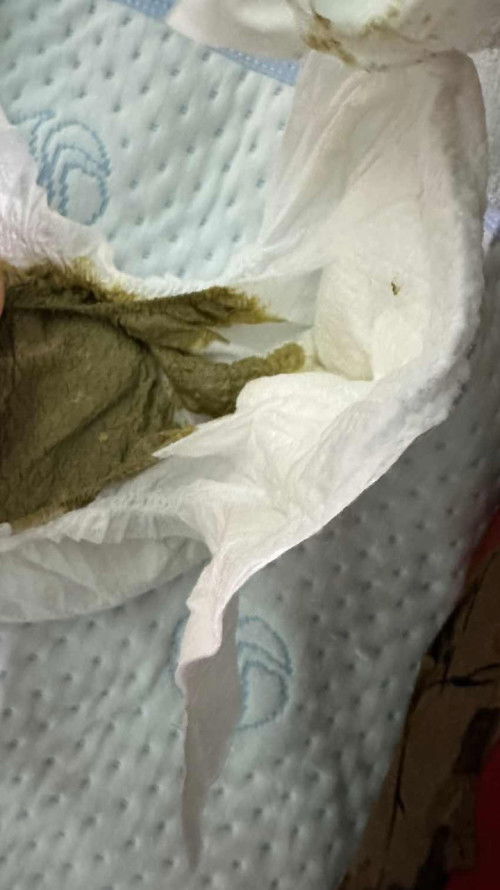 Bé được 1m12d uống meji hoàn toàn, 2,3 ngày đi ị 1 lần gần đây bé đi phân như hình ạ ,e có bs men th