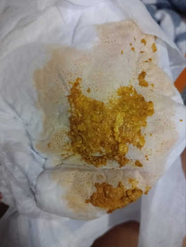 Diarrhea po ba eto?