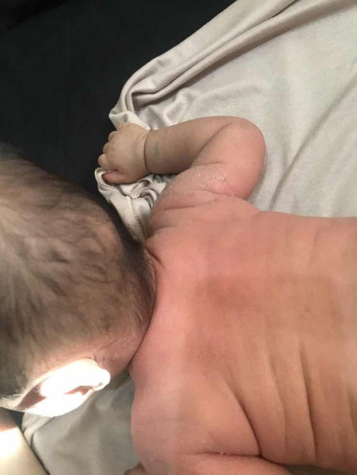 Gatal kulit bayi super kering