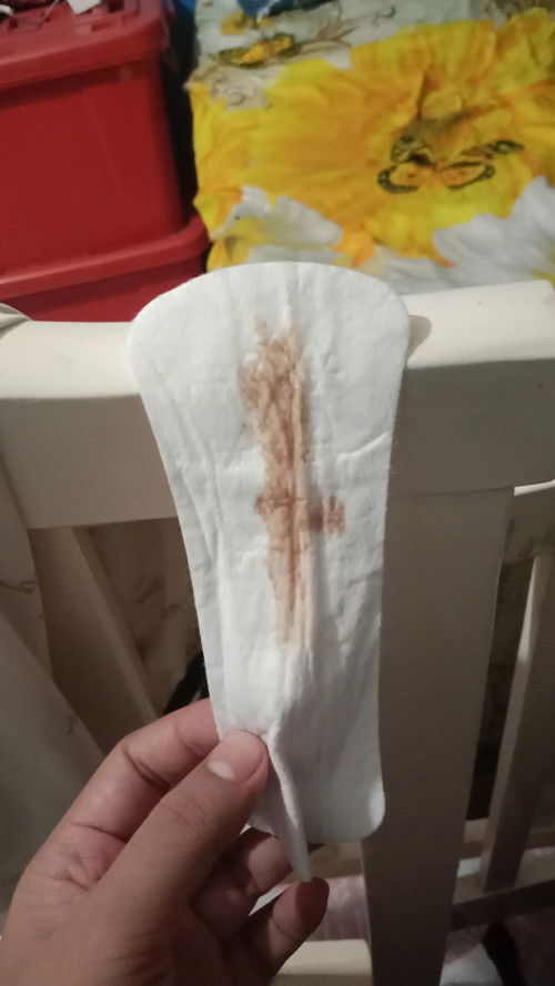 Brown Discharge at 38 weeks