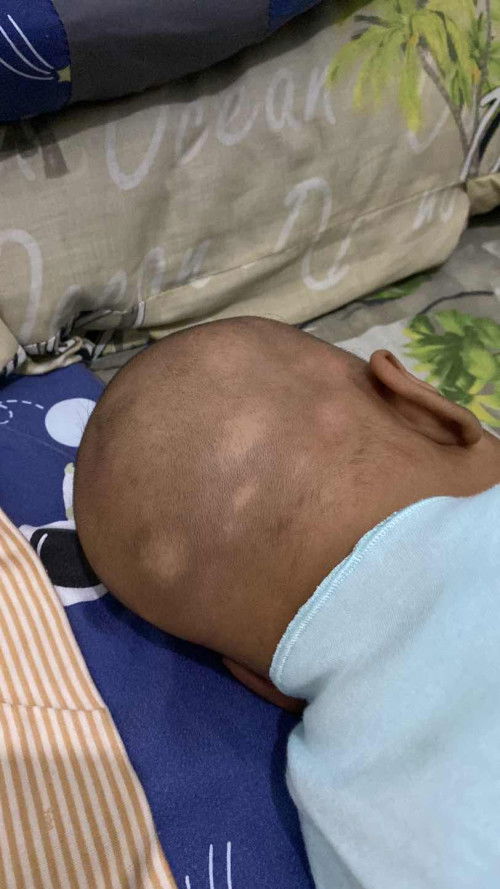 Kulit Kepala bayi putih