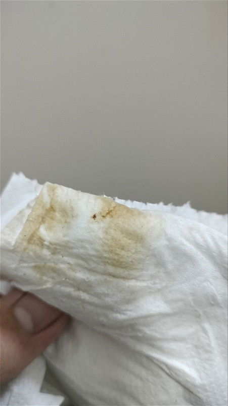 ตกขาวหรือเลือด 32w