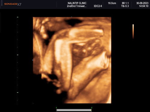 หญิงหรือชายคะ